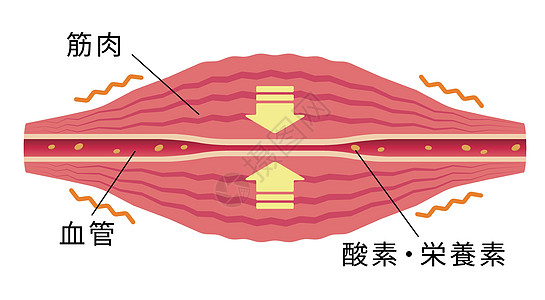 疲劳因素累积 肌肉和血管的平面插图组织纤维脖子器官疼痛肩膀疾病按摩解剖学痛苦图片