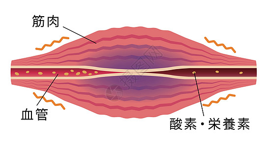 疲劳因素累积 肌肉和血管的平面插图纤维痛苦器官生物学身体组织落枕脖子疾病女士图片