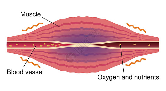 疲劳因素累积 肌肉和血管的平面插图解剖学女士身体药品脖子生物学疼痛组织痛苦科学图片