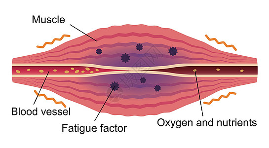 疲劳因素累积 肌肉和血管的平面插图科学肩膀痛苦器官脖子按摩生物学药品身体疼痛图片