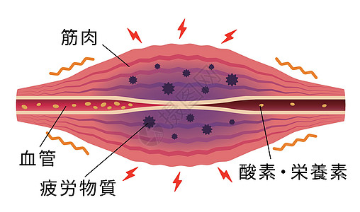 疲劳因素累积 肌肉和血管的平面插图按摩痛苦脖子纤维生物学落枕身体肩膀组织疾病图片