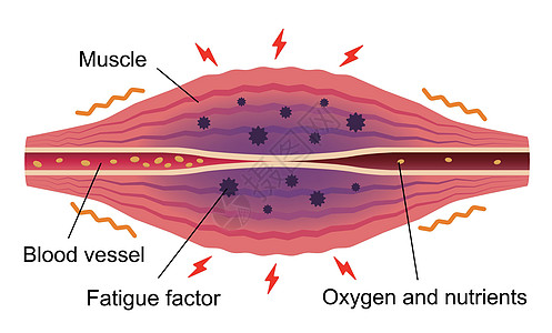 疲劳因素累积 肌肉和血管的平面插图肩膀按摩解剖学脖子纤维药品疾病痛苦身体落枕图片