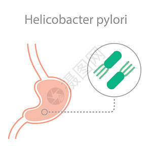 幽门螺杆菌图片