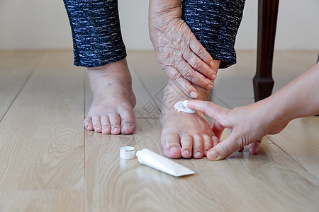 年长妇女照顾者把奶油加在肿胀的脚上药品手指糖尿病疾病老年祖母姑姑奶奶女士脚肿图片