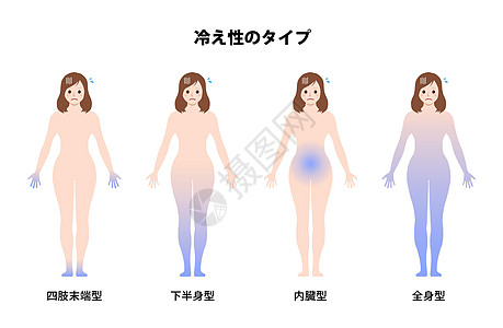 冷敏感性类型循环不良载体它制作图案血液循环温度卡通片症状寒意状况疼痛灵敏度插图寒冷图片