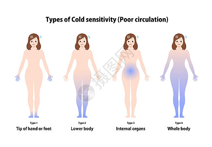 冷敏感性类型循环不良载体它制作图案寒意寒冷灵敏度女士疼痛流感状况插图手指妇女图片