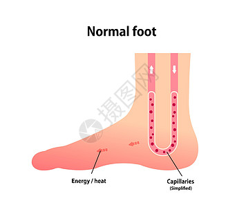 正常足部血液循环制作图案图片