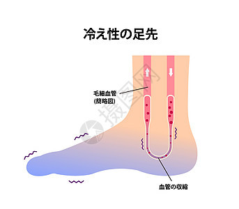 冷脚血液循环插图对寒冷脚趾日本人的敏感性卡通片寒冷成人女性器官蓝色寒潮流感女士疾病背景图片