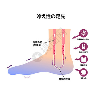 冷脚血液循环插图对寒冷脚趾日本人的敏感性成人流感卡通片寒冷脚趾状况身体器官女士疼痛图片