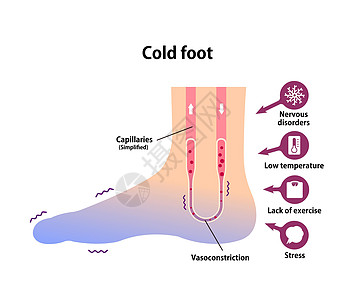 冷脚血液循环图示对冷脚趾的敏感性状况疾病疼痛寒潮女性流感寒冷蓝色温度身体图片