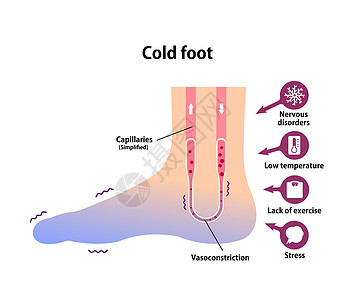 冷脚血液循环图示对冷脚趾的敏感性状况疾病疼痛寒潮女性流感寒冷蓝色温度身体背景图片