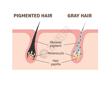 色素头发和灰色头发比较载体制作图案的机制黑色素成人颜料高龄卡通片压力皮肤白发卫生老年图片
