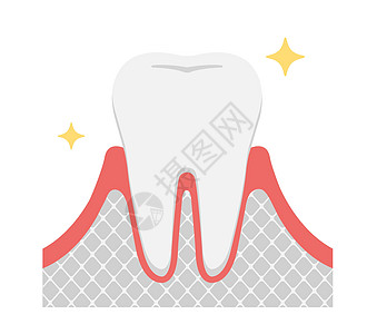 牙周炎疾病的阶段健康嘟嘟图片