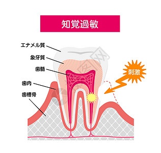 牙齿敏感病媒制作图案的成因及机制口服插图牙科诊所痛苦疾病保健治疗卫生空腔图片