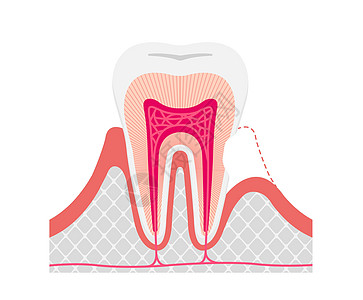 牙齿敏感矢量图解无 tex 的原因和机制图片