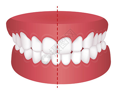 牙齿问题咬合类型矢量图拔牙治疗拥挤口服矫正覆合双牙牙医疾病牙列图片