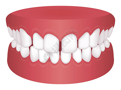 牙齿问题咬合类型矢量图双牙假牙诊所覆合拥挤口服空腔牙医3d牙科图片