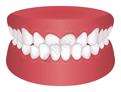牙齿问题咬合类型矢量图 Underbit图片