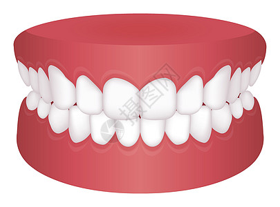 牙齿问题咬合类型矢量图解正常位图片