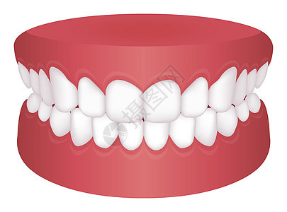 牙齿问题咬合类型矢量图解正常位图片
