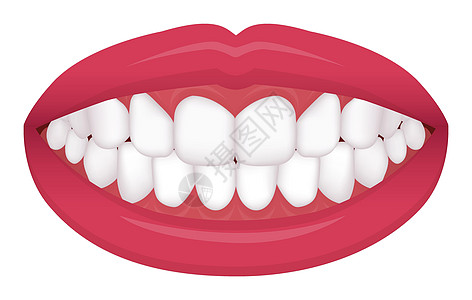 牙齿问题咬合型歪牙矢量图甚至牙齿 正常牙齿图片