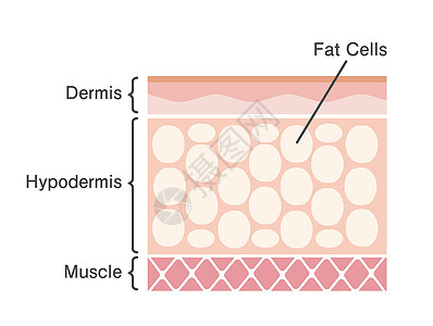 它制作图案的脂肪细胞剖面图程序药品饮食治疗女性损失插管化妆品橘皮吸气图片