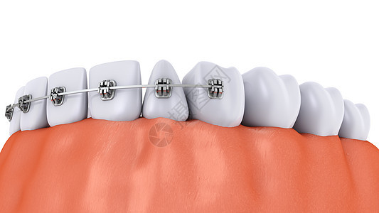 植入和植入牙齿外科搪瓷植入物凹痕磨牙健康药品口腔科卫生牙医图片
