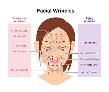 表情皱纹和老化皱纹女性面部矢量图案图片