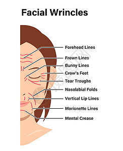 面部皱纹女性面部矢量图制作图案插图卡通片美丽皮肤老化美容脖子鱼尾纹护理前额图片