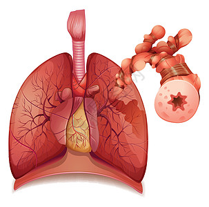 哮喘身体气管插图障碍空腔科学教育支气管图表管道图片