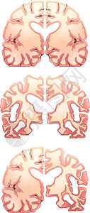人脑中枢神经障碍科学额叶脑脊液哺乳动物健忘症系统过敏反应男人图片