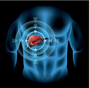 人体硬化图疾病器官卡通片医疗图表x光科学癌症生物症状图片