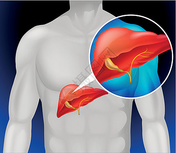肝癌详细图解药品图表插图艺术夹子生物学卫生保健绘画一部分图片