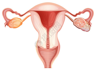 疼痛部位woma卵巢癌疾病艺术科学癌症生物学夹子绘画卡通片图表药品插画