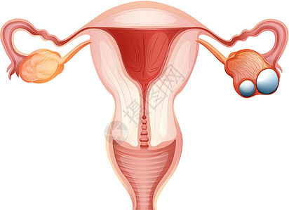 woma卵巢癌图解解剖学治疗插图绘画疾病女士生物学夹子管子症状图片