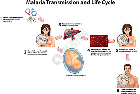 疟疾传播和生命周期婴儿教育夹子剪裁疾病科学绘画发烧生物学插图图片