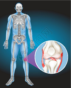 人体和膝盖疼痛图片