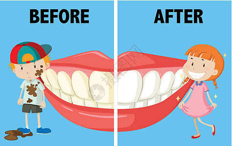 之前和之后的相反词瞳孔绘画白色牙齿激光女孩牙医学生童年牙科图片