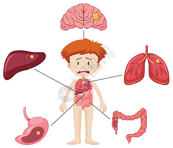 男孩和图表显示患病器官的不同部位图片