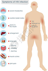 HIV 感染的人体解剖学症状图片