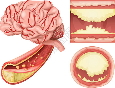 白色背景下的大脑状况图片