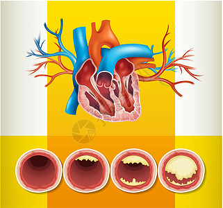 心脏解剖学和 vei 中的脂肪图片