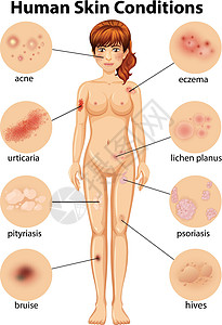人类皮肤状况的人体解剖学图片