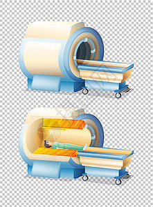 有和没有患者的 MRI 扫描图片