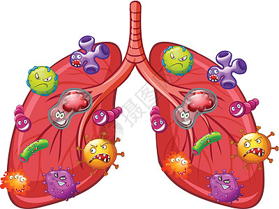 载体空气翼肺部细菌的载体插画