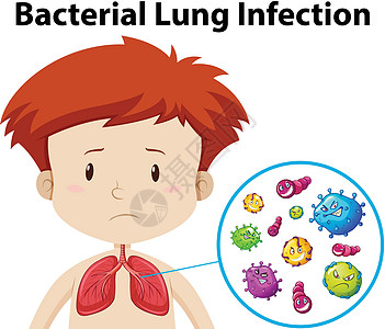 男孩细菌性肺部感染图片