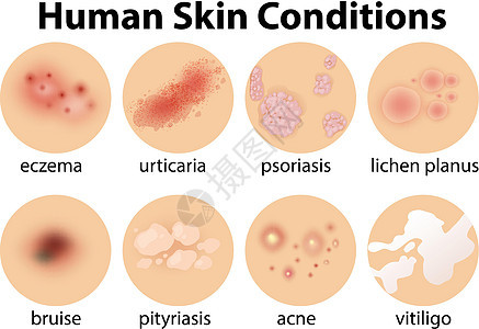 一组人体皮肤状况图片