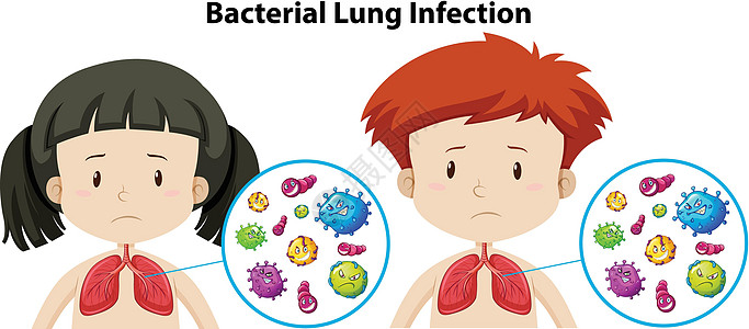 一组细菌性肺部感染图片