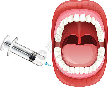 口腔解剖显示胶注射图片