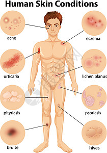 各种人体皮肤状况图片
